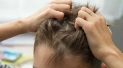 Hol és hány ember élhet a férfi fején kívül?